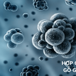 VOC là gì? Hợp chất VOCs có trong sàn gỗ giá rẻ gây nguy hiểm sức khỏe